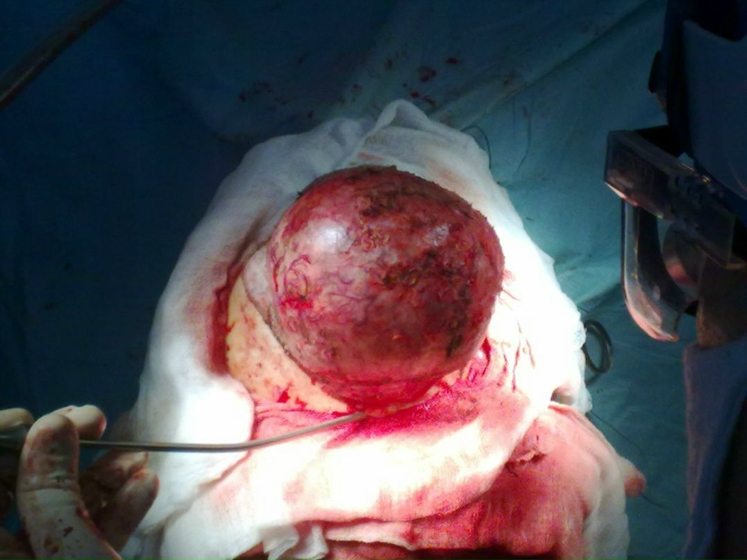 Эльгюн Мамедов | Москва