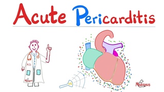Acute Pericarditis, Pericardial Effusions, Dressler Syndrome  Cardiology Series