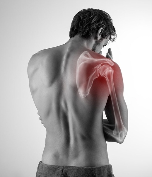 Плечо не поднимается вверх и болит. Мышца поднимающая лопатку упражнения. Плечо не поднимается вверх и болит. Боль в плече при отведении руки. Плечо не поднимается вверх и болит.